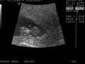 videos de Elizabeth baby sonogram