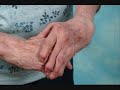 What are the Types of Arthritis and Treatments?