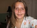 My Orthognathic Surgery