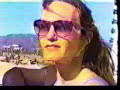 amputee dusty 5