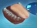 default Discover How to Stop Bad Breath