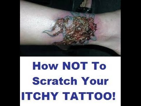 how to relieve itching from mrsa