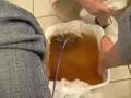 Body Detoxification