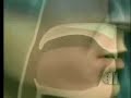 Snoring Solutions - NY Magazine \"Best Doctor\"