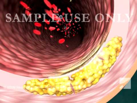 how to grow smooth muscle