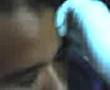 mi perforasion