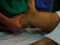 test lachman con cruzado anterior roto