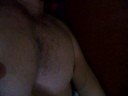 asthma attack with Pectus excavatum (dangerous)