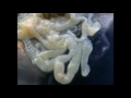 Taenia solium | Biologie mostaganem