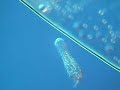 Gastrotricha