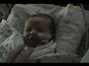 Carson NICU #2