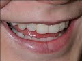 Digital Dental Hygiene with Photoshop Elements and a tablet.