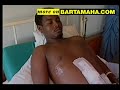 burned alive and beaten to death hate crimes agains Somali s