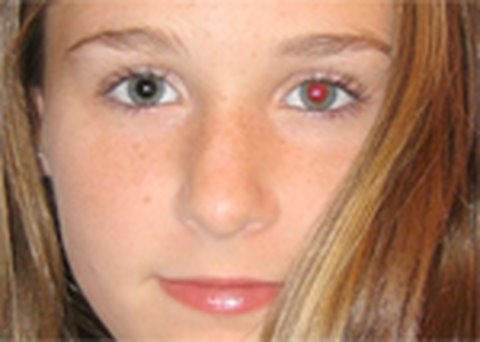 how to get rid of red eye in photoshop cs5