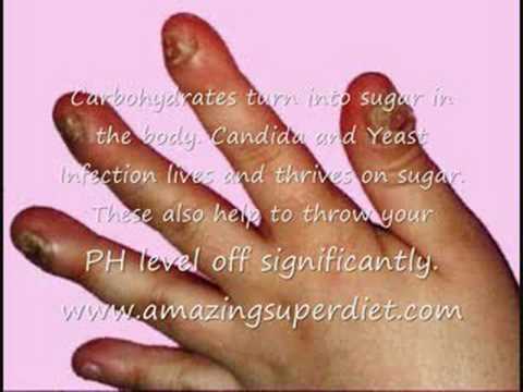 how to treat candida with gse