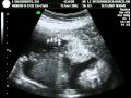 21 semanas + 3 d�as