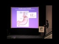 Frank D'Ovidio- Interstitial Lung Disease and Gastroesophageal Reflux (PART 1)