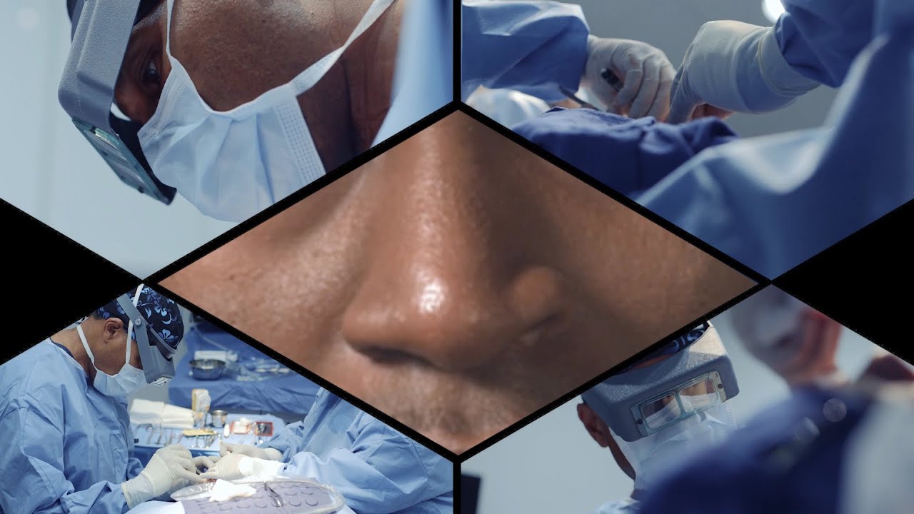Ethnic Rhinoplasty at The Smith Center - Houston Plastic Surgery