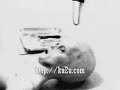 speacial Alien autopsy speacial Alien autopsy