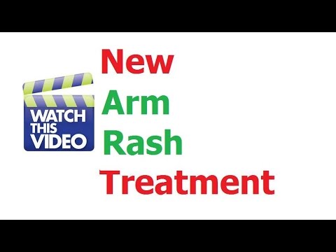 how to treat armpit rash