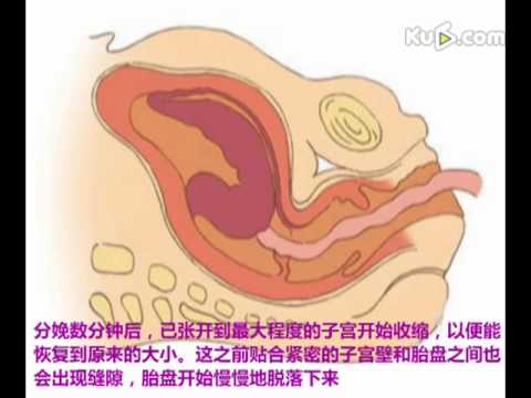 胎儿经过产道的整个过程(视频)