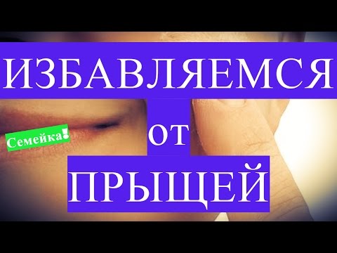 Избавится от прыщей в домашних условиях за один день Избавится от прыщей в домашних условиях за один день