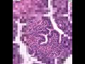 Shotgun Histology Fallopian Tube