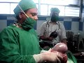 large-ovarian-tumour-removed-in-toto.html