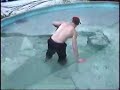 Hypothermia