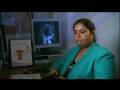 Healthy Discoveries - Uterine Fibroid Embolization