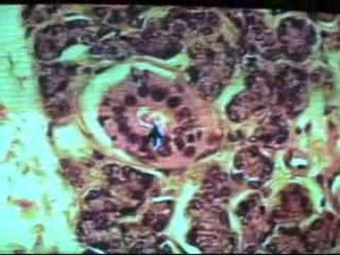Salivary Glands & Pancreas Lab Part ...