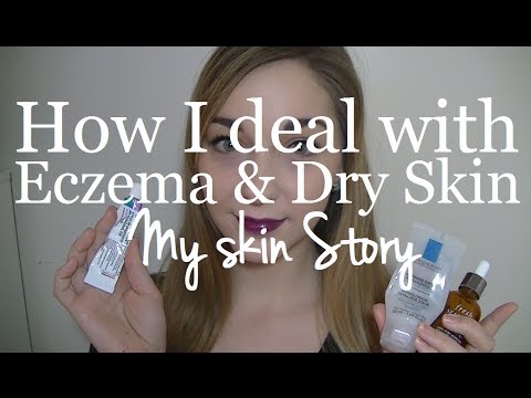 how to deal with eczema