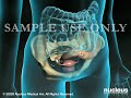 3D Medical Animation: Diagnostic Pelvic Laparoscopy