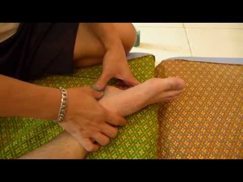 how to treat plantar fasciitis