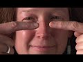 Computer Eye Strain Eye Exercises