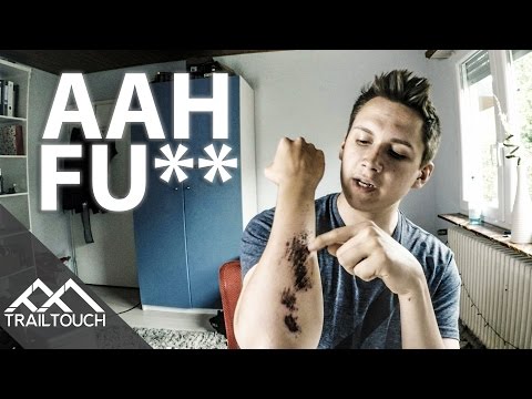 Downhill & Handschuhe = schlechte Idee?! - Eure Fragen