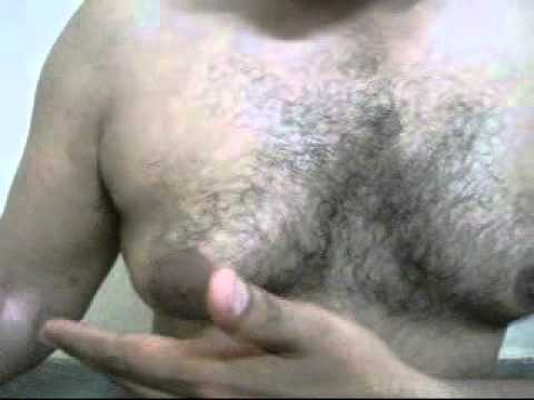 how to self check for gynecomastia