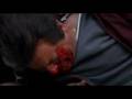 Pesci Beatdown - Casino