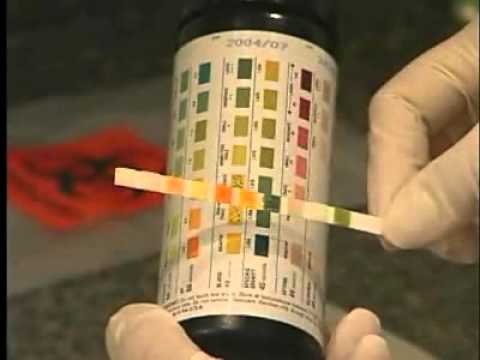 how to obtain urinalysis