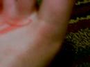Bloody Left Foot