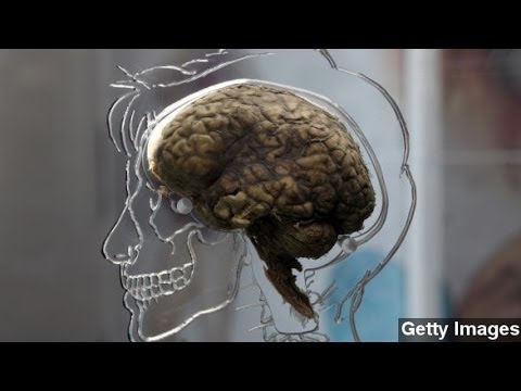 how to discover switch