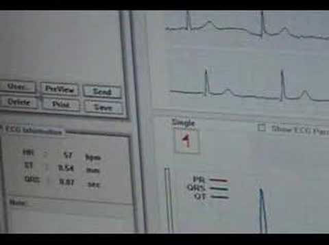 electrocardiografo