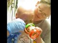 Feeding Tube