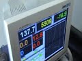 Dyno runs during tuning