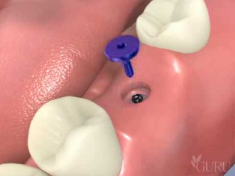 Image de prévisualisation YouTube