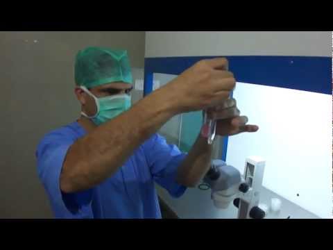 how to collect sperm for ivf