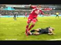 Wasilewski Horror Leg Break/Worst Ever 31/08/09