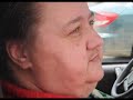Obese woman leaks fluid from her legs