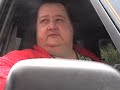 Obese woman leaks fluid from her legs