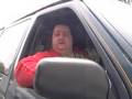 Obese woman leaks fluid from her legs